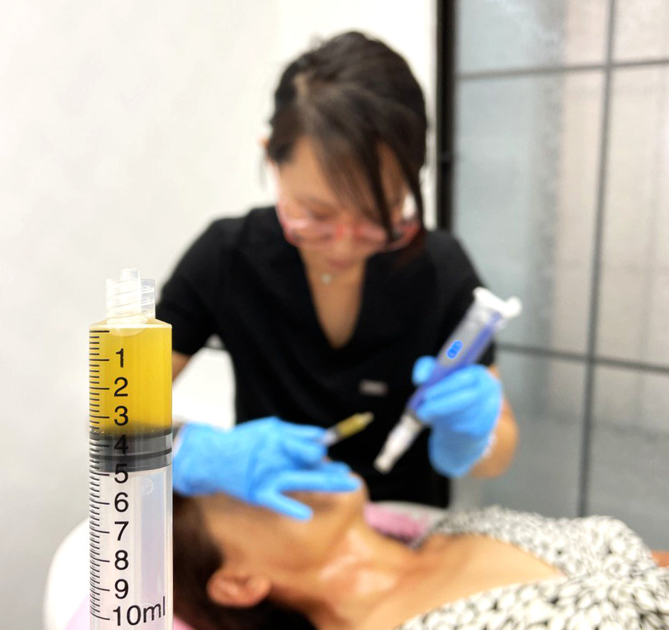 PRP and Microneedling Live Demo