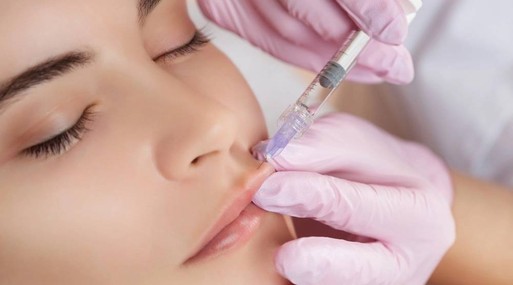 Is the trend of over-filled lips coming to an end? How to dissolve lip fillers for a more natural appearance.